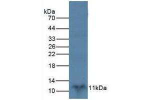 Figure. (S100B antibody  (AA 1-92))