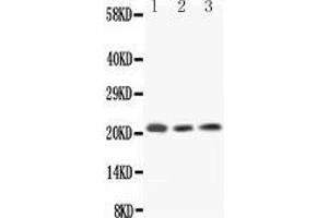 Western Blotting (WB) image for anti-Interleukin 18 (IL18) (AA 37-194) antibody (ABIN3042518) (IL-18 antibody  (AA 37-194))