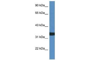 Western Blot showing ACER1 antibody used at a concentration of 1 ug/ml against HCT15 Cell Lysate (ACER1 antibody  (C-Term))