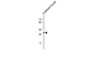 Anti-Z1 Antibody (N-Term)at 1:1000 dilution + human skeletal muscle lysates Lysates/proteins at 20 μg per lane. (AMZ1 antibody  (AA 65-96))