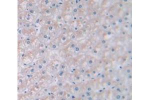 Figure. (RPN1 antibody  (AA 308-438))