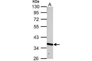Western Blotting (WB) image for anti-phosphoribosyl Pyrophosphate Synthetase 1 (PRPS1) (N-Term) antibody (ABIN2855446)