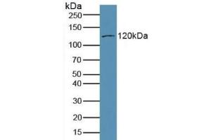 Detection of MYO1A in Mouse Brain Tissue using Polyclonal Antibody to Myosin IA (MYO1A) (Myosin IA antibody  (AA 783-1043))