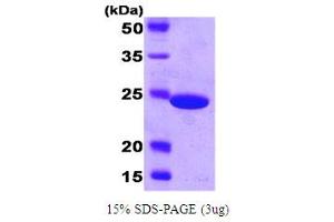 SDS-PAGE (SDS) image for Carbonic Anhydrase (CA) (AA 1-220) protein (His tag) (ABIN667077) (Carbonic Anhydrase Protein (CA) (AA 1-220) (His tag))