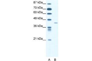 WB Suggested Anti-SSTR4 Antibody Titration: 1. (SSTR4 antibody  (Middle Region))