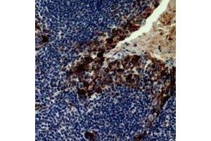 Immunohistochemical analysis of CD21 staining in human tonsil formalin fixed paraffin embedded tissue section. (CD21 antibody)