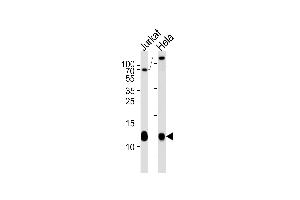 B2M Antibody (N-term) (ABIN1539903 and ABIN2843857) western blot analysis in Jurkat,Hela cell line lysates (35 μg/lane). (beta-2 Microglobulin antibody  (AA 10-39))