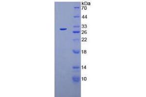 SDS-PAGE analysis of Mouse Plasminogen Protein. (PLG Protein)