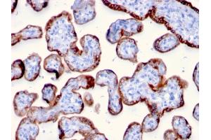 Immunohistochemistry (IHC) image for anti-Pregnancy-Associated Plasma Protein A, Pappalysin 1 (PAPPA) (AA 351-523) antibody (ABIN6940248)