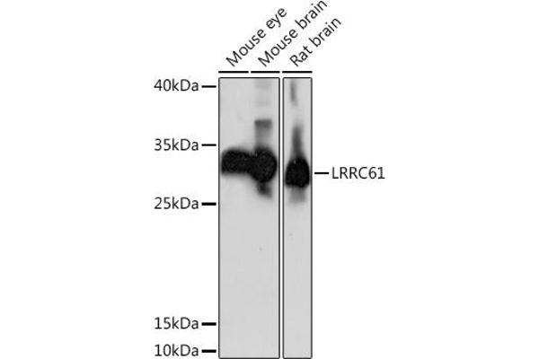 LRRC61 抗体  (AA 1-259)