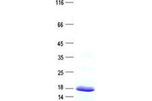 Validation with Western Blot (CSAG3 Protein (His tag))