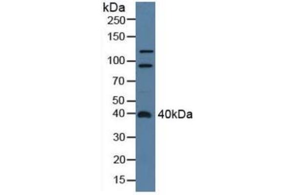 ADAP2 anticorps  (AA 49-360)