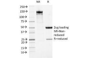 SDS-PAGE Analysis Purified ATRX Mouse Monoclonal Antibody (23c). (ATRX antibody)