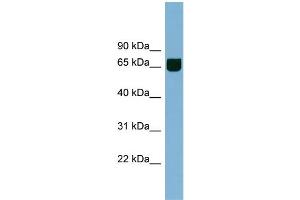 WB Suggested Anti-RIC8B Antibody Titration: 0. (RIC8B antibody  (Middle Region))