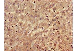 Immunohistochemistry of paraffin-embedded human liver tissue using ABIN7152690 at dilution of 1:100 (FARP1 antibody  (AA 1-300))