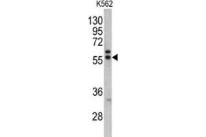 Western Blotting (WB) image for anti-Preferentially Expressed Antigen in Melanoma (PRAME) antibody (ABIN5022672) (PRAME antibody)