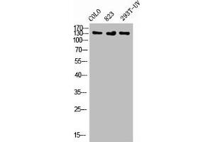 Western Blot analysis of COLO 823 293T-UV cells using Phospho-Flt-1 (Y1048) Polyclonal Antibody (FLT1 antibody  (pTyr1048))