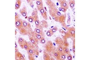 Immunohistochemistry (IHC) image for anti-Wilms Tumor 1 (WT1) antibody (ABIN7308510)