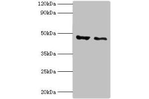 Western blot All lanes: PLIN2 antibody at 4 μg/mL Lane 1: HepG2 whole cell lysate Lane 2: Hela whole cell lysate Secondary Goat polyclonal to rabbit IgG at 1/10000 dilution Predicted band size: 48 kDa Observed band size: 48 kDa (ADRP antibody  (AA 168-437))