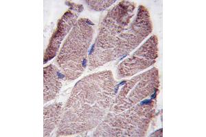Formalin-fixed and paraffin-embedded human skeletal muscle tissue reacted with PTPD1 antibody (Center), which was peroxidase-conjugated to the secondary antibody, followed by DAB staining. (PTPN21 antibody  (AA 751-780))