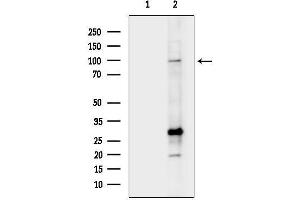 anti-3-Hydroxy-3-Methylglutaryl-CoA Reductase (HMGCR) (N-Term) antibody