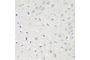 Immunohistochemistry of paraffin-embedded human esophagus using KPNA3 antibody at dilution of 1:100 (40x lens).
