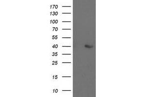 HEK293T cells were transfected with the pCMV6-ENTRY control (Left lane) or pCMV6-ENTRY ALDOB (Right lane) cDNA for 48 hrs and lysed. (ALDOB antibody)