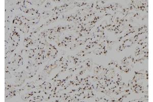 ABIN6279505 at 1/100 staining Human lung tissue by IHC-P. (TGIF2LX antibody)
