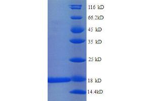 30S Ribosomal Protein S11 (AA 2-129), (full length) protein (His tag) (30S Ribosomal Protein S11 (AA 2-129), (full length) protein (His tag))