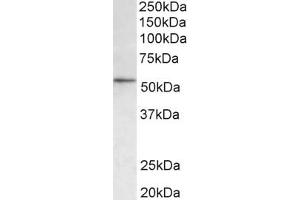 Western Blotting (WB) image for anti-Histone Deacetylase 1 (HDAC1) (AA 385-396) antibody (ABIN1101988) (HDAC1 antibody  (AA 385-396))