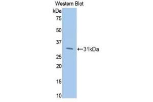 Detection of Recombinant PIK3Cb, Human using Polyclonal Antibody to Phosphoinositide-3-Kinase Catalytic Beta Polypeptide (PIK3Cb) (PIK3CB antibody  (AA 807-1070))