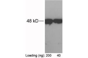 Loading: RFP-tag fusion protein expressed in E. (RFP antibody)