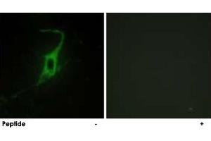 Immunofluorescence analysis of NIH/3T3 cells, using CDH20 polyclonal antibody . (Cadherin 20 antibody)