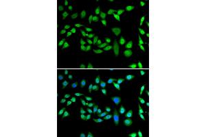 Immunofluorescence analysis of U2OS cells using DNAJB6 antibody.