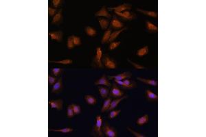 Immunofluorescence analysis of U-2 OS cells using PDE6D Polyclonal Antibody (ABIN7269303) at dilution of 1:100 (40x lens). (PDE6D antibody  (AA 1-150))