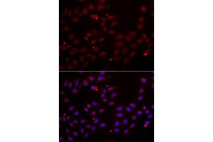 Immunofluorescence analysis of HeLa cells using CST2 antibody. (CST2 antibody)