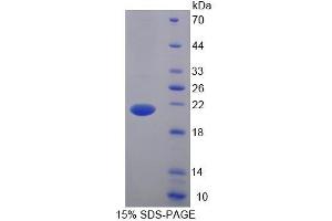 SDS-PAGE (SDS) image for B and T Lymphocyte Associated (BTLA) (AA 30-183) protein (His tag) (ABIN6238775) (BTLA Protein (AA 30-183) (His tag))