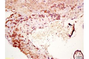 Formalin-fixed and paraffin embedded human placenta labeled with Anti-IL-7 Polyclonal Antibody, Unconjugated (ABIN734783) at 1:200 followed by conjugation to the secondary antibody and DAB staining (IL-7 antibody  (AA 51-154))