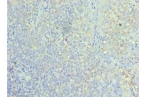 Immunohistochemistry of paraffin-embedded human tonsil tissue using ABIN7155295 at dilution of 1:100 (ASF1A antibody  (AA 1-204))