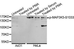 Western blot analysis of extracts of various cell lines, using Phospho-MAP3K5-S1033 antibody. (ASK1 antibody  (pSer1033))