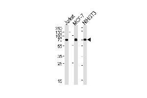 RPS6KB2 Antibody (ABIN659036 and ABIN2838051) western blot analysis in Jurkat, MCF-7, mouse NIH/3T3 cell lysates (35 μg/lane).