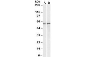 Western blot testing of human [A] and rat [B] lung lysates with Calreticulin antibody at 0. (Calreticulin antibody)