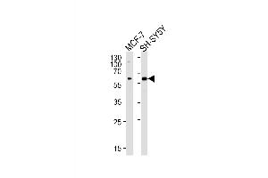 ZBTB22 antibody  (C-Term)