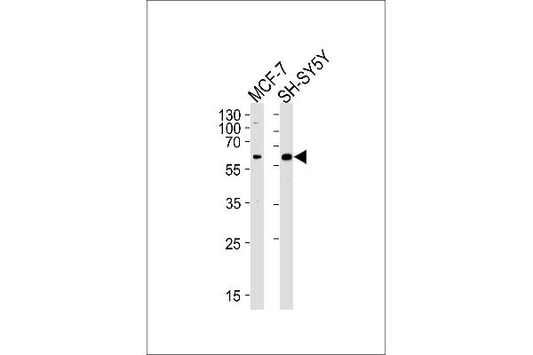 ZBTB22 Antikörper  (C-Term)