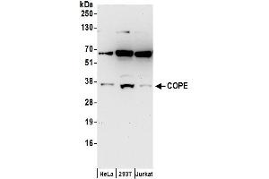 anti-Coatomer Protein Complex, Subunit epsilon (COPE) (AA 1-50) antibody