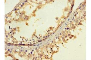 Immunohistochemistry of paraffin-embedded human testis tissue using ABIN7152269 at dilution of 1:100 (EXD2 antibody  (AA 137-245))