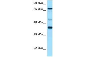Western Blotting (WB) image for anti-Hyaluronan Synthase 1 (HAS1) (N-Term) antibody (ABIN2789475)