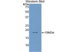 Detection of Recombinant IL11Ra, Human using Polyclonal Antibody to Interleukin 11 Receptor Alpha (IL11Ra)