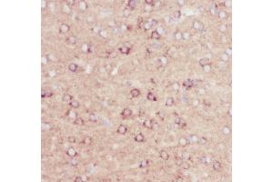 Anti-beta Amyloid Picoband antibody,  IHC(P): Mouse Brain Tissue