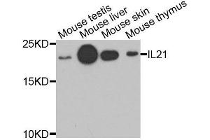 Western blot analysis of extracts of various cell lines, using IL21 antibody. (IL-21 antibody  (AA 25-162))